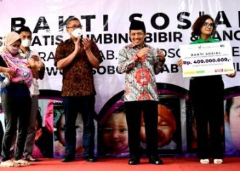 Operasi Bibir Sumbing, Sido Muncul Beri Bantuan Rp 400 Juta