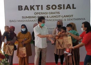 Sido Muncul Sumbang Rp 280 Juta Operasi Bibir Sumbing Gratis Anak-anak
