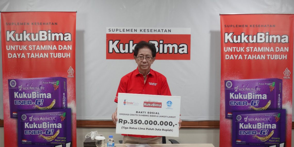 Sido Muncul Gandeng Smile Train Indonesia Gelar Operasi Bibir Sumbing